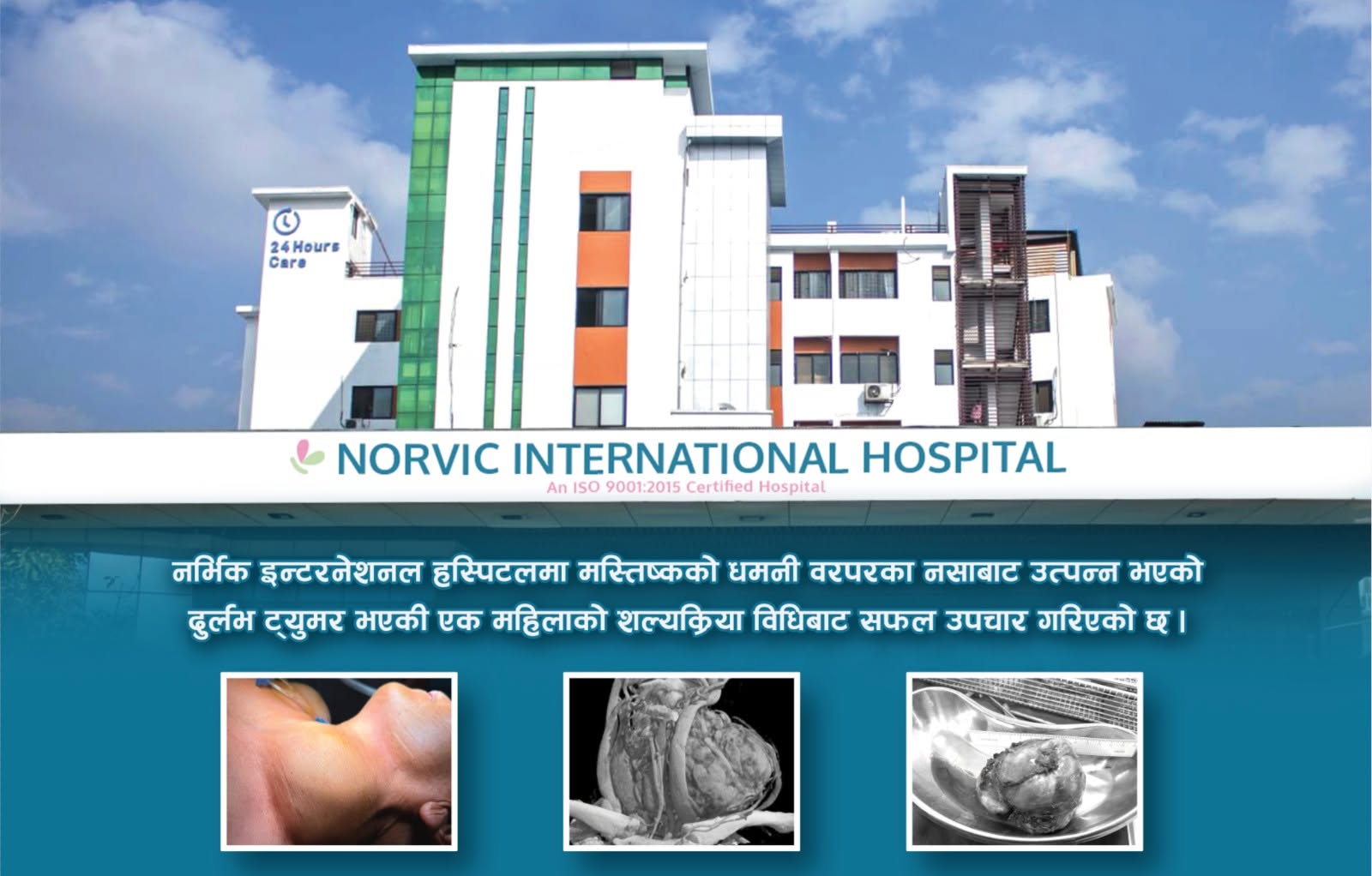 नर्भिकमा मस्तिष्कको धमनी नजिकको दुर्लभ ट्युमरको सफल शल्यक्रिया
